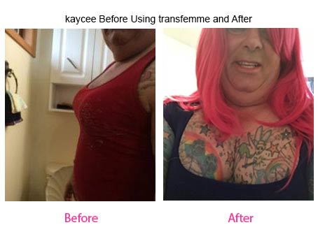 Kaycee Before using Transfemme & After