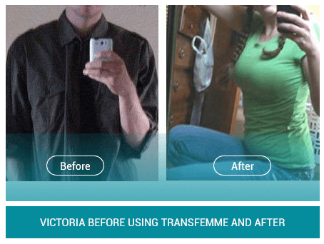 Male Breast Enlargement Male To Female Transition Transfemme