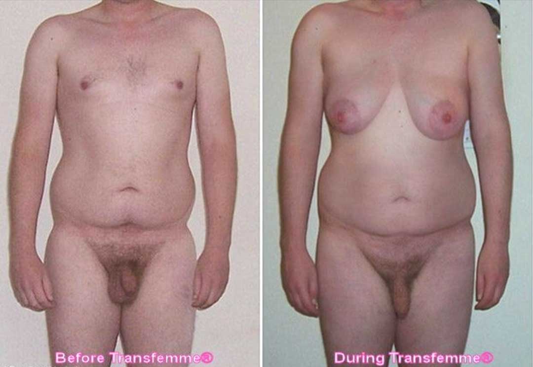 Bovine ovary before and after pictures male,bovine ovary for male breast enlargement,bovine ovary mtf before and after,bovine ovary mtf